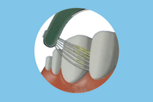 Technologia Buletedana